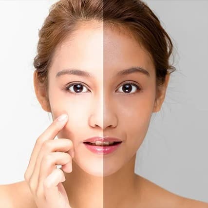 Skin brightening